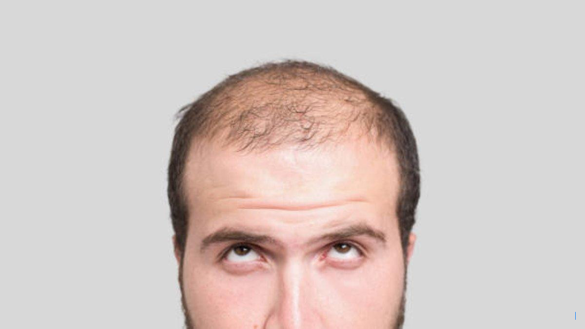 20 Serum Rambut BPOM untuk Cegah Kebotakan